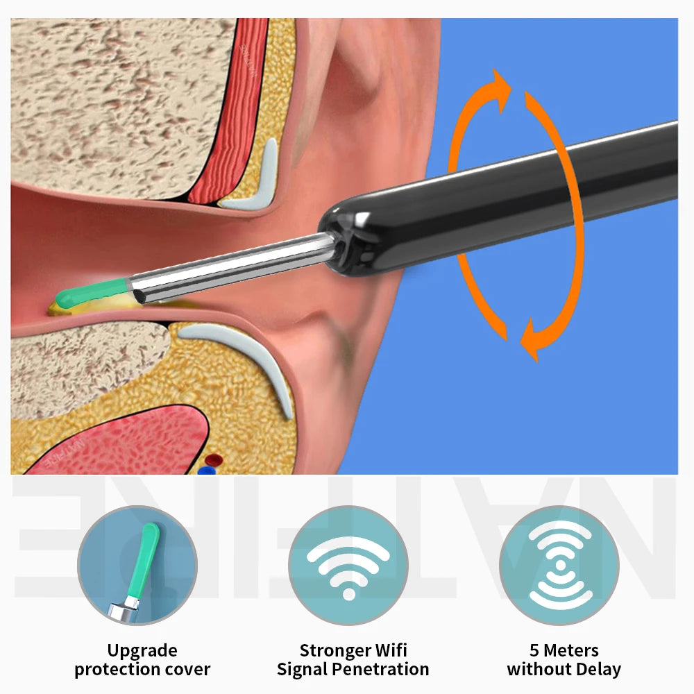 Smart EarScope - Wi-Fi Visual Otoscope